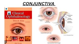 Chap7 pt7 Conjunctiva shafi mjatoiquick review complete chapter [upl. by Sivi]