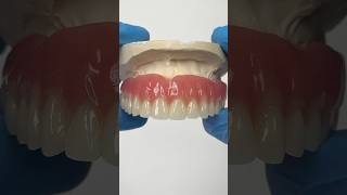 Reline Denture lsk121shorts dentistry teeth [upl. by Nemrac311]