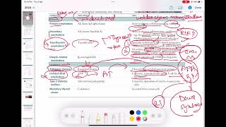 localised amyloidosis pathology 22  First Aid USMLE Step 1 in UrduHindi [upl. by Irok]