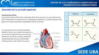 Electrocardiograma Parte 2 [upl. by Jess294]