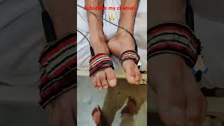 T t Patient Tracheostomy 10 month per day video [upl. by Trula955]