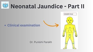 Neonatal Jaundice Part II [upl. by Le]