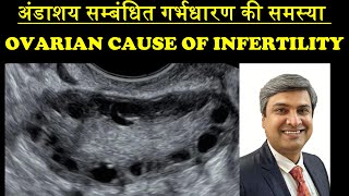 अंडाशय सम्बंधित गर्भधारण की समस्या  OVARIAN CAUSE OF INFERTILITY [upl. by Lorrie]