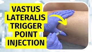 Trigger Point Injection Vastus Lateralis Technique [upl. by Dovev]