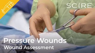 Pressure Wounds Wound Assessment [upl. by Labana]