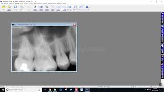 Training Apteryx XrayVision 4 Moving Images Between Patient Charts [upl. by Ahsaret]