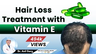 Hair loss Treatment with Vitamin E  बालो के लिए घरेलु उपचार  Vitamin E Capsule For Hair Growth [upl. by Aikemot]