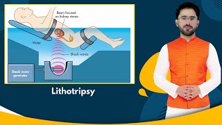 Promo  12  Lithotripsy  PPSC Lecturer ZoologyBiology [upl. by Dnalhsa]