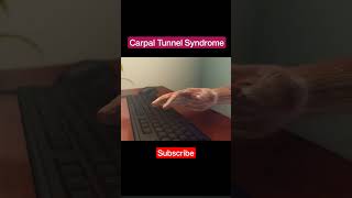 Carpal Tunnel Syndrome 3d animation shorts by MWM Medical [upl. by Houghton]