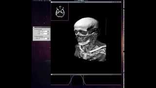 CT scan viewer [upl. by Ecirtaemed]