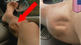 Muscle cramps explained What’s causing this guy’s leg to spasm horrifically  TomoNews [upl. by Reifel]