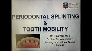 Periodontal Splinting amp Tooth mobility [upl. by Gabbey96]