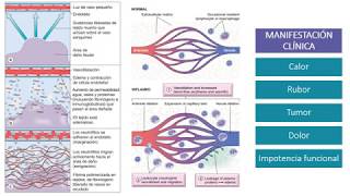 Fisiopatología  Inflamación [upl. by Hicks14]