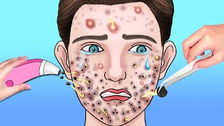 ASMR Giant Acne amp Black Head Pimple Removal  Acne Deep Cleaning Animation  ASMR Animation [upl. by Ger]