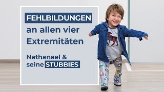 Dysmelie bzw Fehlbildungen an allen 4 Gliedmaßen  Laufen mit Stubbies [upl. by Nehttam739]