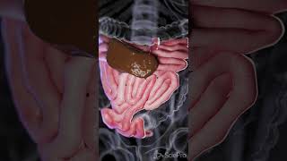 Understanding Small Bowel Perforation anatomy biology 3danimation [upl. by Enelahs]