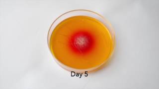 DTM Fungal Culture Growth of Ringworm [upl. by Hueston]