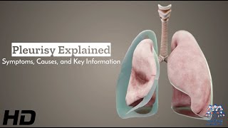 Pleurisy Unveiled Understanding Symptoms Causes and Vital Information [upl. by Babara167]