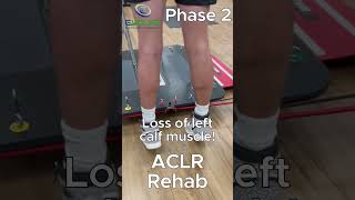 One Exercise That is Critical for Successful ACL Reconstruction Recovery  Pediatric ACL Rehab [upl. by Theresina807]