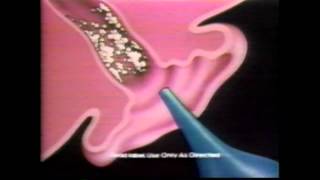 Murine Earwax Removal 1990 [upl. by Razal411]