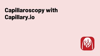 Tutorial How to perform Capillaroscopy with Capillaryio [upl. by Esej]