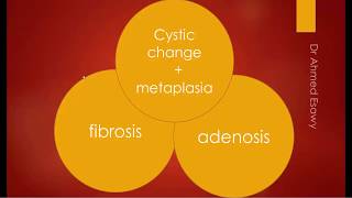 Breast fibrocystic change fibroadenosis sonomammography MRI [upl. by Lewse]