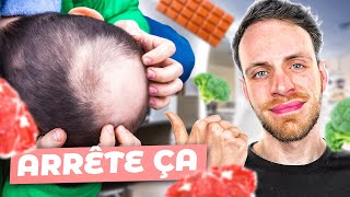 Vous perdez vos cheveux  Essayez ces 6 aliments  alopécie calvitie [upl. by Pelmas392]