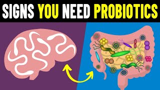 9 Signs You Need To Take Probiotics [upl. by Noell]