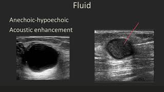 Ultrasound 101 Part 5 Terminology and Tissuesmp4 [upl. by David]