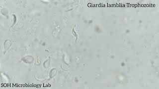 Giardia lamblia Trophozoite in stool [upl. by Haduj13]