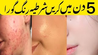 Beauty cream for face  acne treatment cream  Blackhead treatment  Open pores treatment [upl. by Ecylla593]