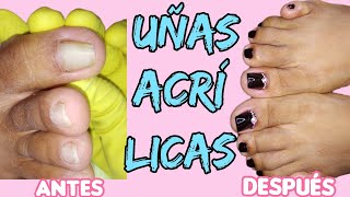 🥰Como Poner Uñas Acrílicas en los Pies Paso a Paso Embelle Ser💯 [upl. by Gold779]