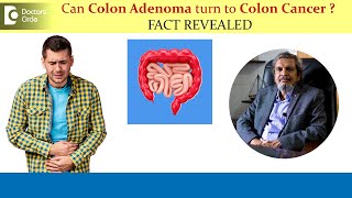 Can Colon Adenoma turn to Colon Cancer  Colon Polyp Removal Dr Rajasekhar M R  Doctors Circle [upl. by Philbo]