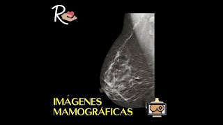 Imágenes Mamográficas ¿Qué se ve cuando te hacen una Mamografía Serie de la Mamografía 68 [upl. by Ahsit804]