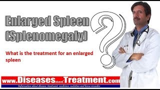 Enlarged Spleen Splenomegaly What is the treatment for an enlarged spleen [upl. by Seidler]