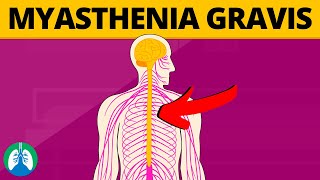 Myasthenia Gravis Medical Definition Quick Explainer Video [upl. by Plantagenet]