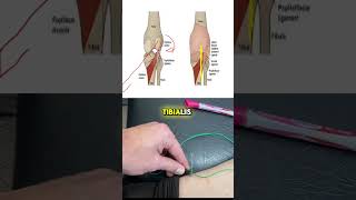 The Difference Between Tibialis Posterior amp Popliteus  Electroacupuncture [upl. by Nosnek264]