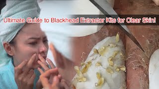 Ultimate Guide to Blackhead Extractor Kits for Clear Skin [upl. by Christophe]