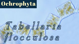 Tabellaria flocculosa Bacillariophyceae or Diatoms [upl. by Odine225]