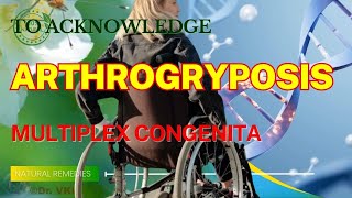 Arthrogryposis Multiplex Congenita  Natural Remedies [upl. by Pan]