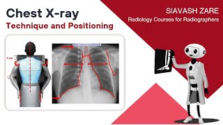 Chest Xray PA Technique and Positioning [upl. by Aicat655]