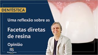 Uma reflexão sobre as Facetas de Resina Composta Opinião [upl. by Yelda]