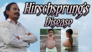 Hirschsprungs disease dha moh prometric [upl. by Acisset]