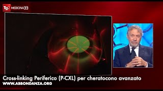 Intervento cheratocono avanzato PCXL  Dr Abbondanza al Tg2 [upl. by Isia744]