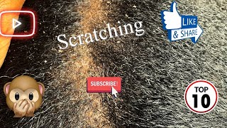 Getting my Head Scratche🤗🤗and it felt Good the best head scratcher ASMR DANDRUFFREMOVAL [upl. by Mylor431]