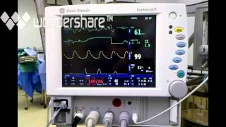 anesthesia induction monitor [upl. by Quartas313]