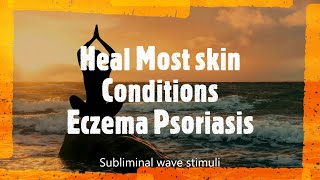 Heal Skin Conditions Eczema Psoriasis Subliminal NLP Frequency [upl. by Farra885]