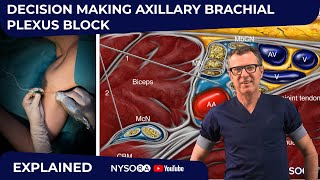 Axillary Block Decision Making Explained  Crash course with Dr Hadzic [upl. by Roseanna817]