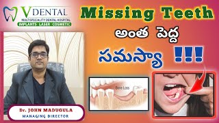 పన్ను లేకపోవడం అంత పెద్ద సమస్యా  V Dental Hospital  Best Dental Hospital  dentalcare [upl. by Jillayne]