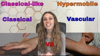 Differences Between cEDS clEDS vEDS and hEDS  Ehlers Danlos Types [upl. by Karlie]